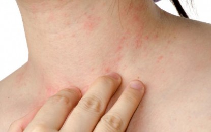 Al menos 8 estudiantes del Sena afectados por inhalación de sustancia no identificada