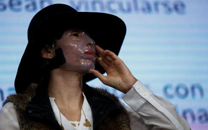 Campaña en el Valle del Cauca protegerá a mujeres víctimas de ataques con ácido