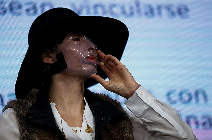 Campaña en el Valle del Cauca protegerá a mujeres víctimas de ataques con ácido