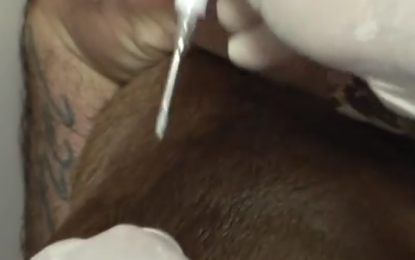 Mil caninos han sido registrados a través de implantación con microchip en Cali