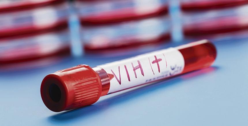 Aumenta la cifra de VIH Positivos en la población más jóven del Valle