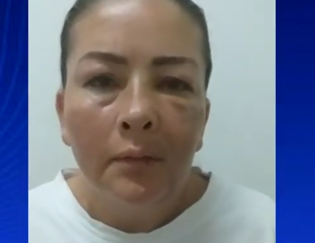 Mujer denuncia ser víctima de agresión por parte de un policía en Cali