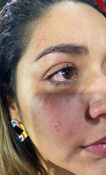 Mujer fue golpeada cuando se encontraba en el partido América vs. Tolima