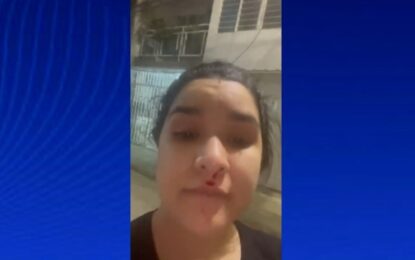 Denuncian a patrullera de la Policía presuntamente por golpear en la cara a una vecina