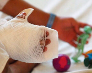 Vigilancia por quemados con pólvora en el Valle deja 68 casos y 25 menores afectados