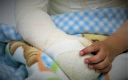 Una madre roció alcohol a su hija y luego le prendió  fuego