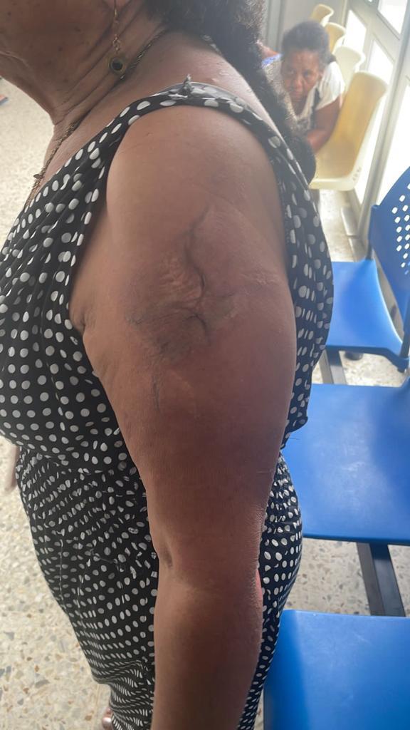 Hombre ataco con sustancia química a su esposa